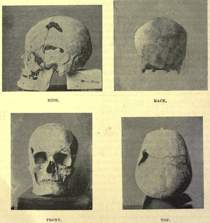 Possible skull of the ancient Egyptian giant-pharaoh, Sa-Nakht.