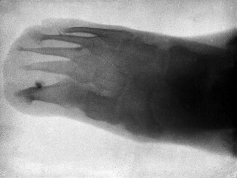 Six-year-old Leonard Schuster's foot in 1896. One suspects he struggled to keep still. 