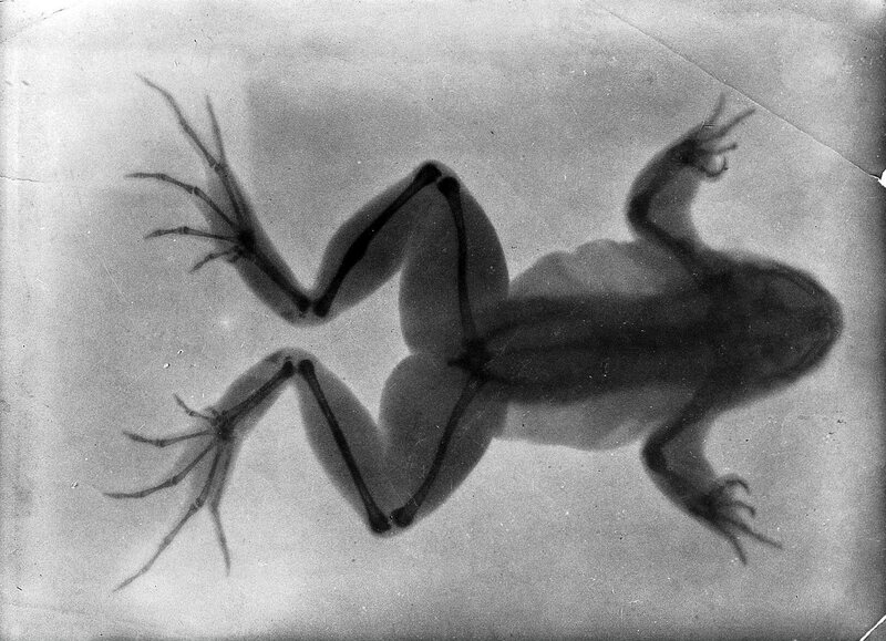 This 1896 radiograph by Arthur Schuster shows a frog with a healed broken bone (the thicker part of hind leg at top).