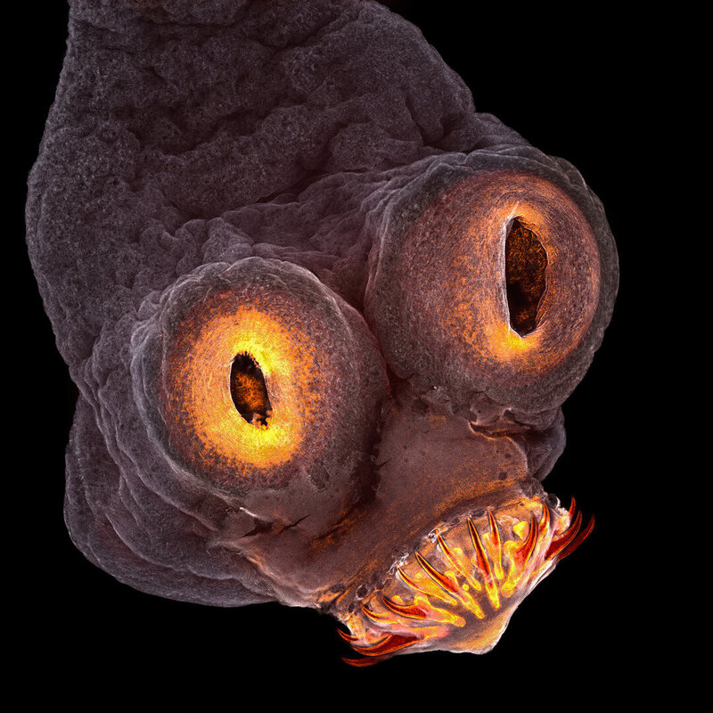 <em>Taenia solium</em> (tapeworm) everted scolex, or head (4th Place). 