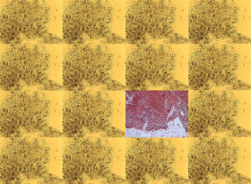 Carrot and apple skin under the microscope, from <em>Forensic Plant Science</em>.