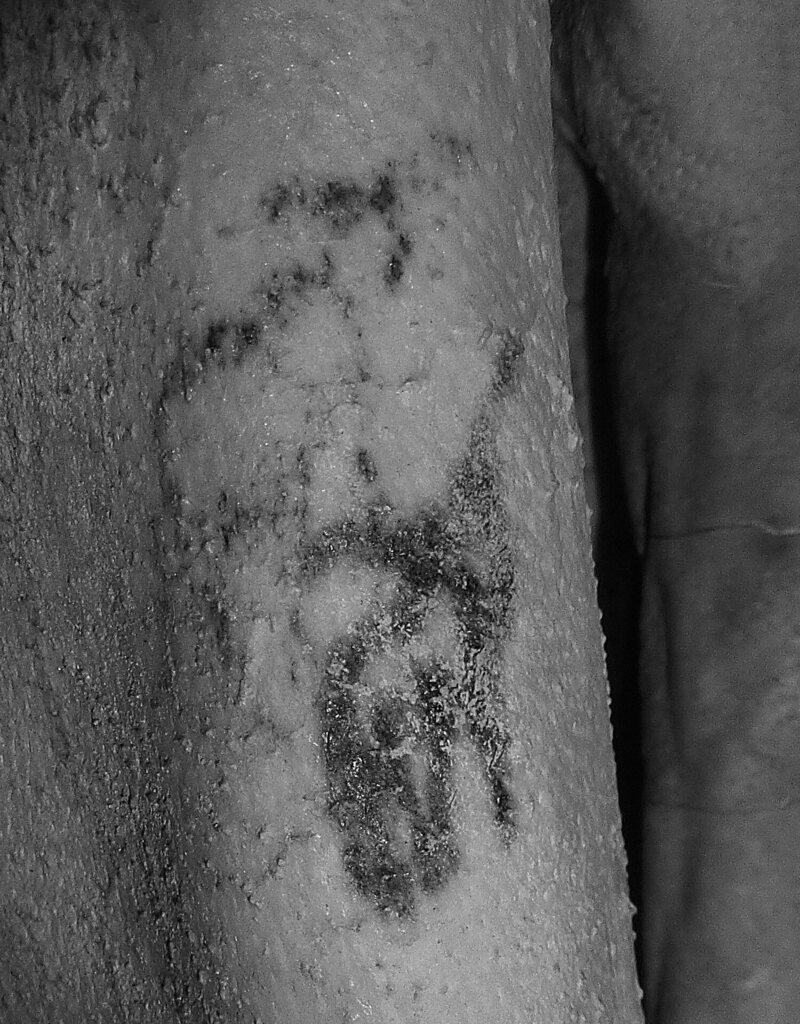 Detail of the tattoos observed on the male mummy's right            arm under infrared light.