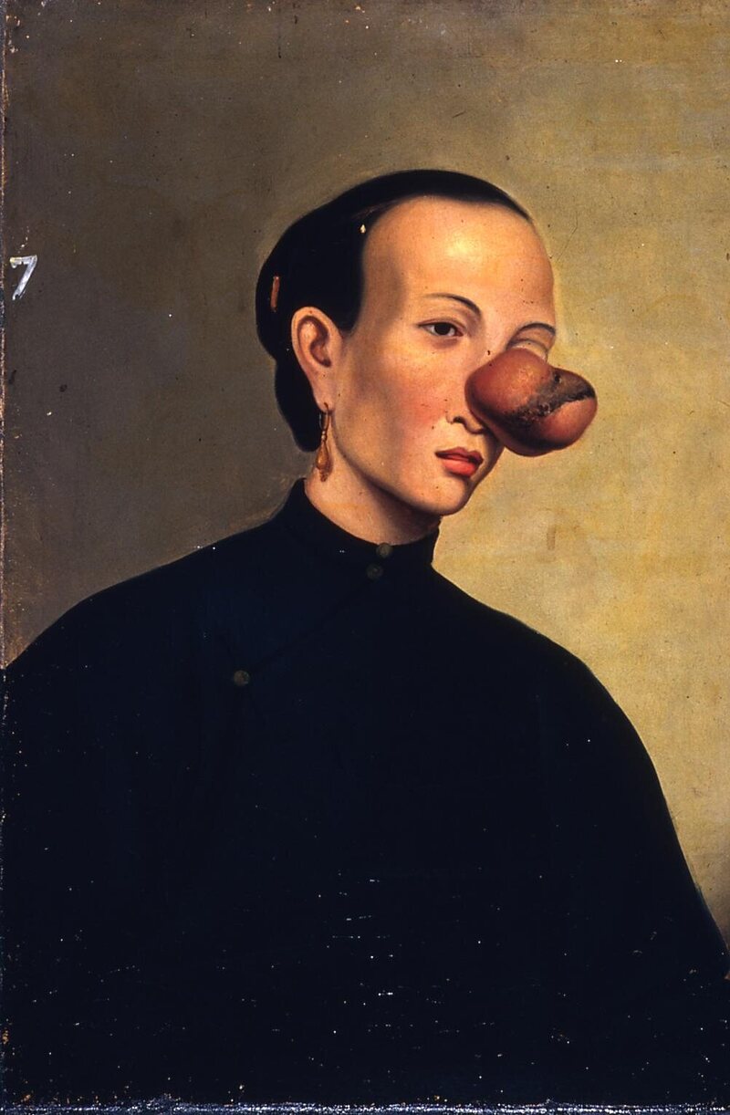 <em>Portrait Number 7</em>, showing a woman with a tumor on the bridge of her nose.