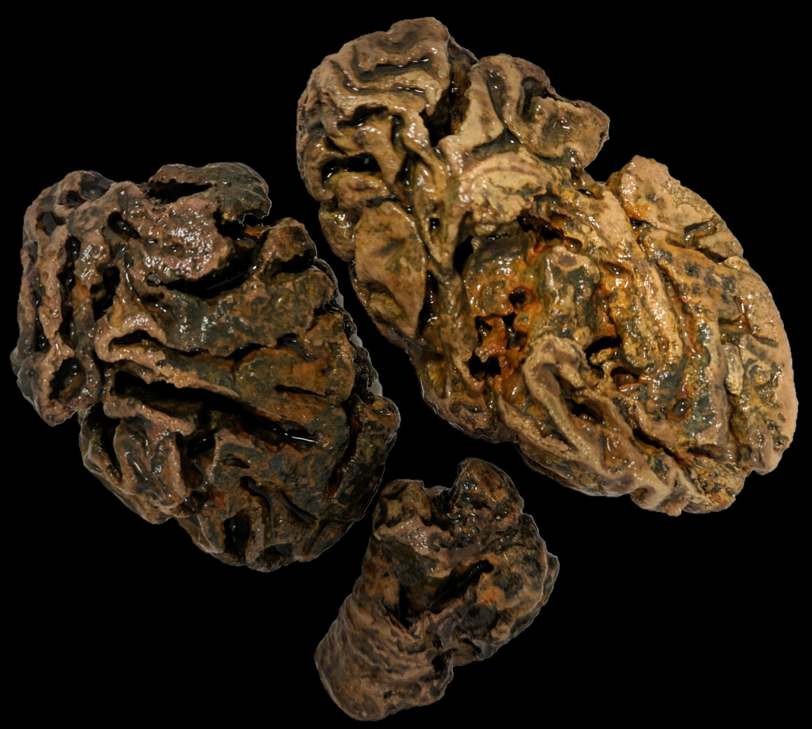 The Mystery of 4,400 Preserved Brains—And One Scientist’s Quest to Solve It