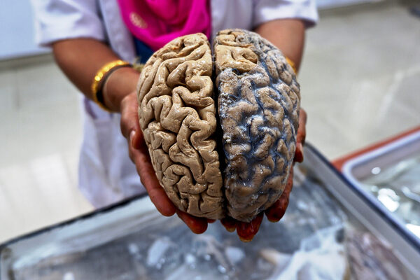 Visitors Can Touch Human Brains At This Indian
