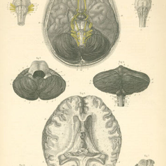 Brain 23. Институт исследования мозга. Верхняя Швабия Фогт.